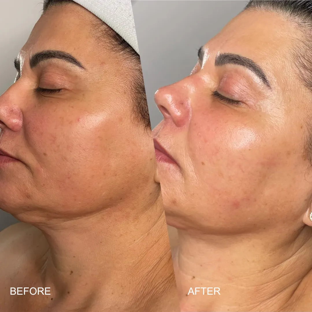 Skin Aura client before and after: firmer, lit-from-within glow